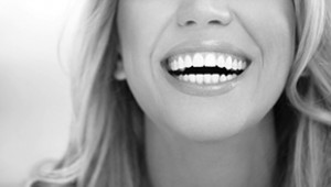 Harley Street veneers dentist smiling face women with dental veneers
